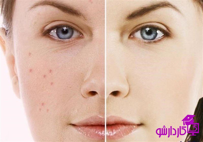 خواص قزل آلا برای پوست